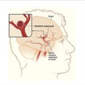 Coma Patient Wakes Up in Nick of Time