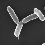 Salmonella Tphimurium