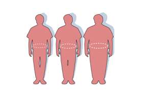 Obesity shortens life