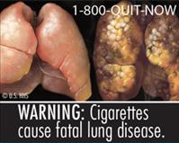 FDA one of nine new cigarette warning labels