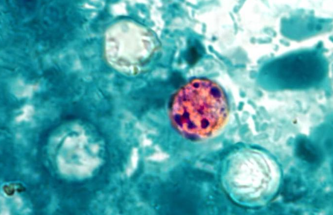 cyclosporiasis outbreak