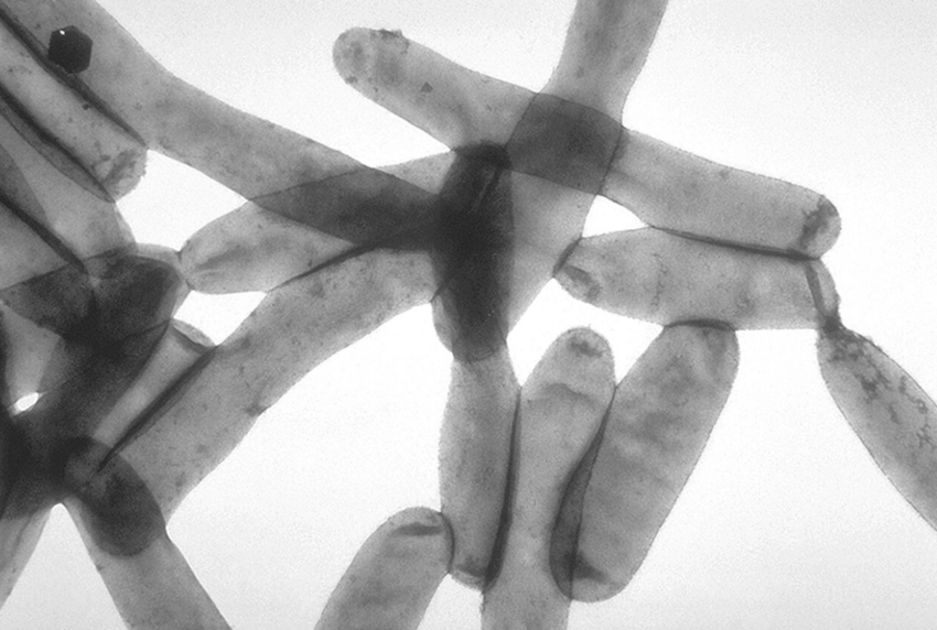Transmission electron microscopy image of L. pneumophila, responsible for over 90% of Legionnaires' disease cases