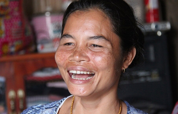 Laughing woman with teeth